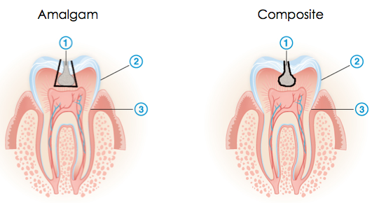 Mitch Marder - November 2014 - Mercury Free Fillings_html_216eb76
